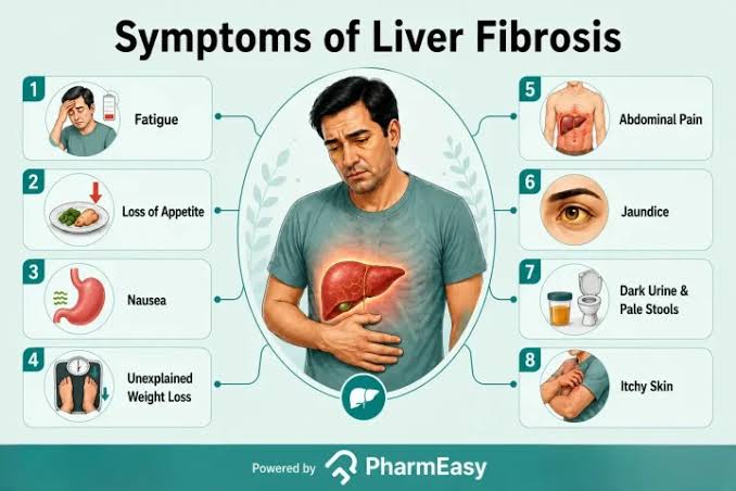 Understanding Congenital Hepatic Fibrosis: Causes, Symptoms, and Management